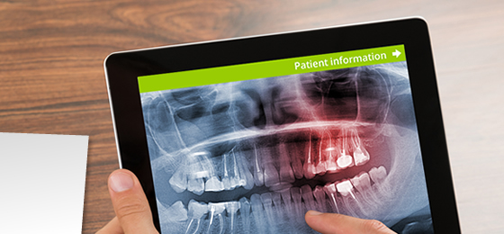 A dentist revising digital x-rays of haws and teeth.